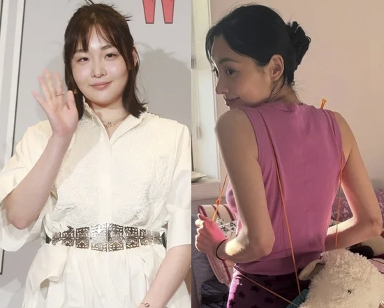 "주근깨·살 빼기 싫다" 소신파 <b>배우</b> <b>김민하</b>의 '뼈말라' 근황!