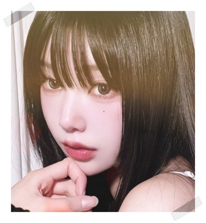 침샘비대증 치료, 보톡스로 갸름한 턱선 찾기