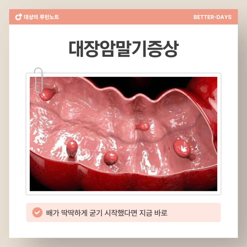 대장암말기증상 '이 신호' 4가지, 절대 그냥 넘기면 안 됩니다