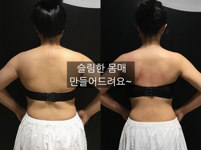 옷태의 핵심은 부유방빼기 흉통줄이기 입니다.