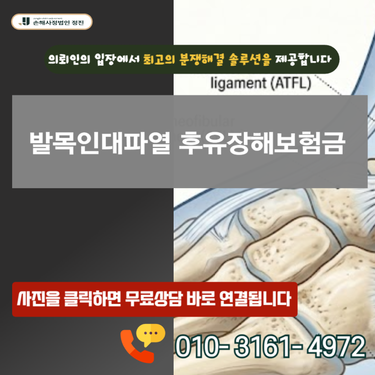  발목인대파열 후유장해 보험금 놓치면 평생 후회 합니다.