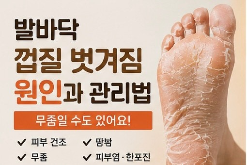 발바닥 껍질 벗겨짐 관리법, 보습만으로 될까?