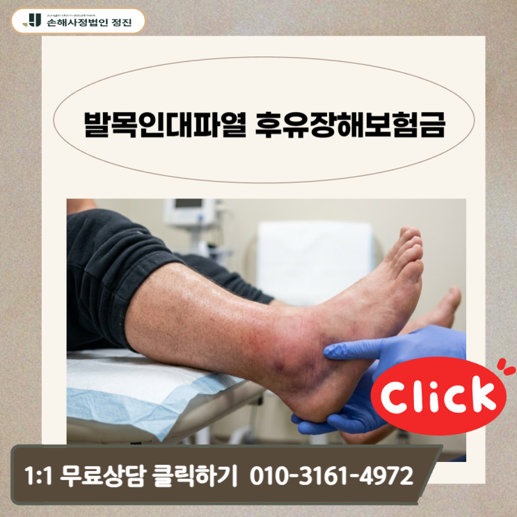  발목인대파열 후유장해 보험금, 수술 후에도 발목이 덜렁거린다면 반드시