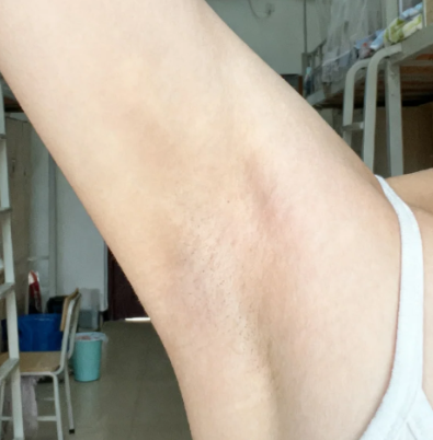  까만 겨드랑이 착색크림 1년 내내 이것만 쓰는중