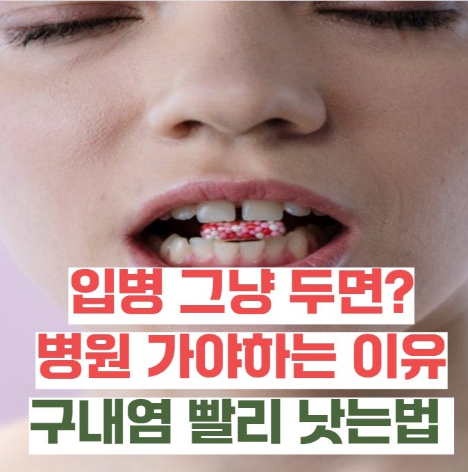 "입병, 그냥 두면 낫겠지"… 2주 넘으면 병원 가야 하는 이유와 구내염 빨리 낫는 법 5가지