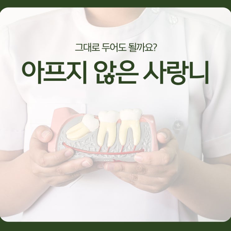  아프지 않은 사랑니, 그대로 두어도 될까요?