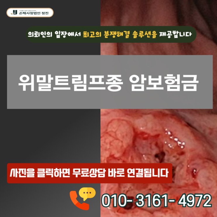  위말트림프종 암보험금, C88.4 코드 받고도 푼돈만 준다는 보험사의 꼼수 대응법