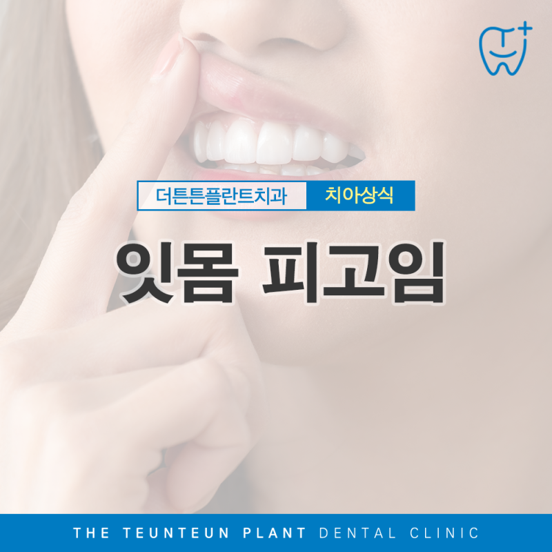 잇몸 피고임이 생기는 이유는?