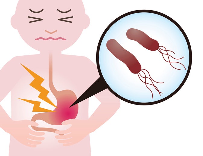 헬리코박터균 자연치유 될까? 치료 없이 방치하면 생기는 위험은?