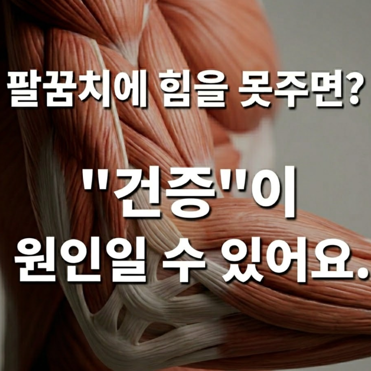  병뚜껑을 열때 팔꿈치가 아파서 힘을 못 준다면?? 테니스 엘보가 아니라 건증(Tendinosis)일 수 있습니다.