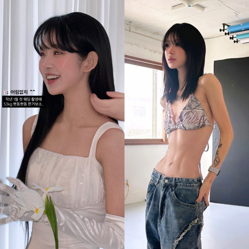 "96kg→41kg" 최준희 뼈말라 추구미... 저체중 다이어트가 위험한 이유
