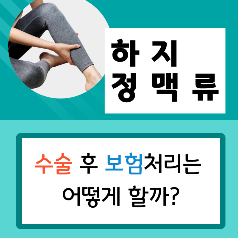 하지정맥류 수술, 미용일까 질병일까? 실비보험 적용 기준 알기 쉽게  정리해 드려요!