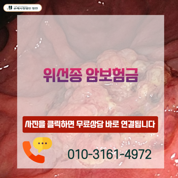  위선종 암보험금, D13.1 코드라도 제자리암 진단비 1,500만 원 받을 수 있는 결정적 이유