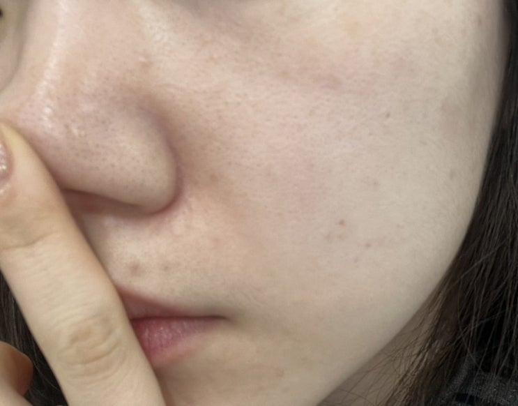  올리브영 폼클렌징 추천 메디힐 더마크림 팩클렌저, 딥클렌징까지 가능한