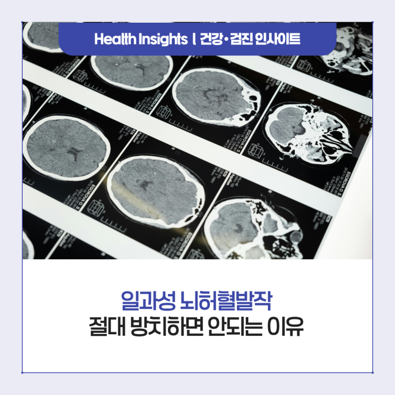 왜 일과성 뇌허혈발작을 방치하면 안 될까?