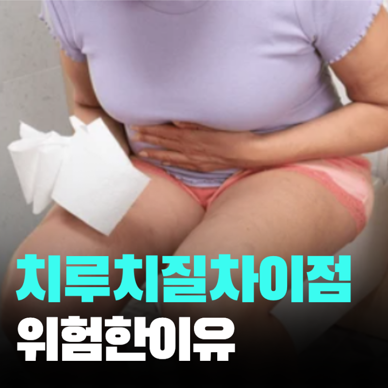 치루치질 차이 증상별 대처법