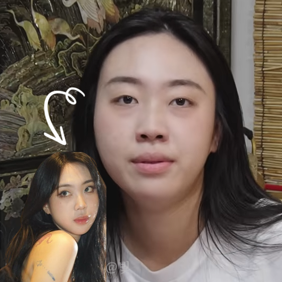 Lee Young-ji's Under-Eye Fat Repositioning! She Did It Because She Looked Tired