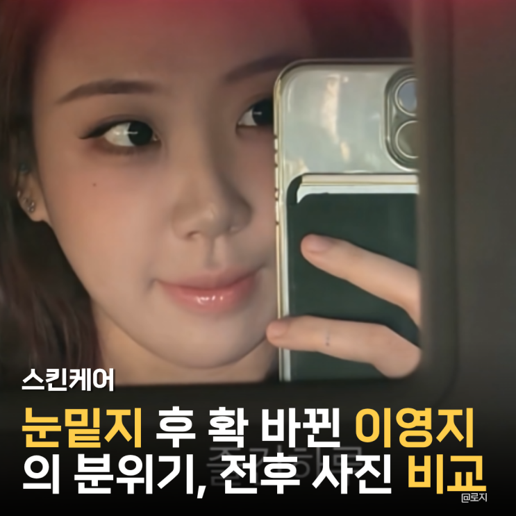  "누구세요?" 눈밑지 후 확 달라진 이영지, 역대급 비주얼 변화