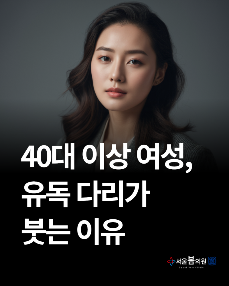 대전 하지정맥류 서울봄의원, 중년여성 다리 불편감에 대하여