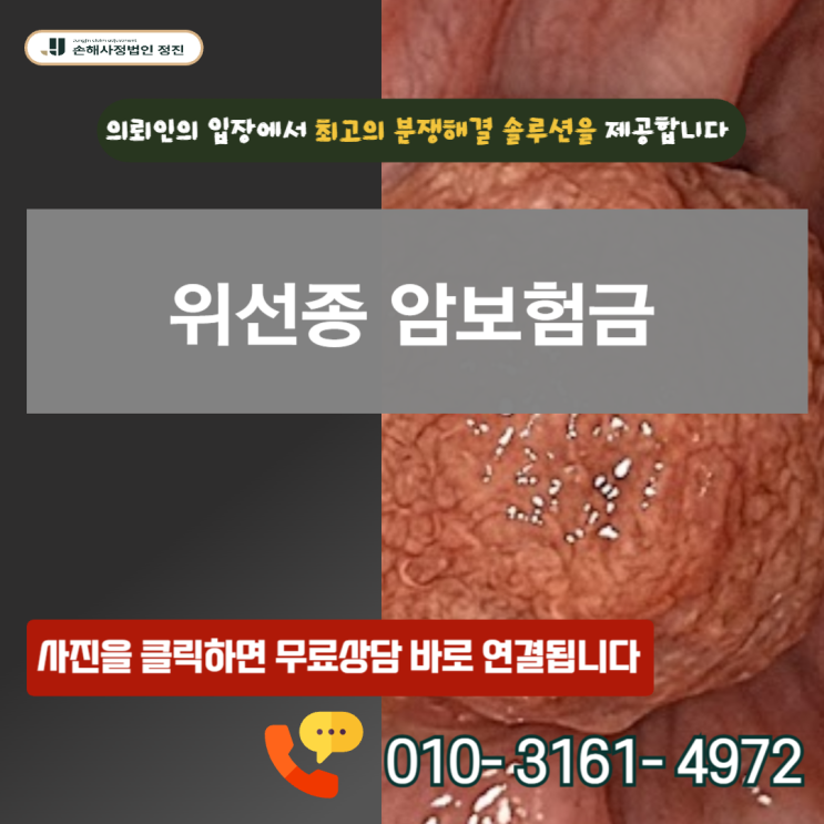  위선종 암보험금, D13.1 코드에도 전액 수령이 가능했던 결정적 이유