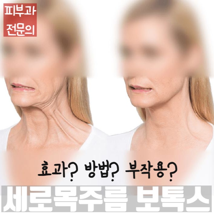  세로목주름(수직목근띠)과 우글우글한 목주름 보톡스의 효과, 방법, 부작용(연하곤란/발성장애/목굽힘)