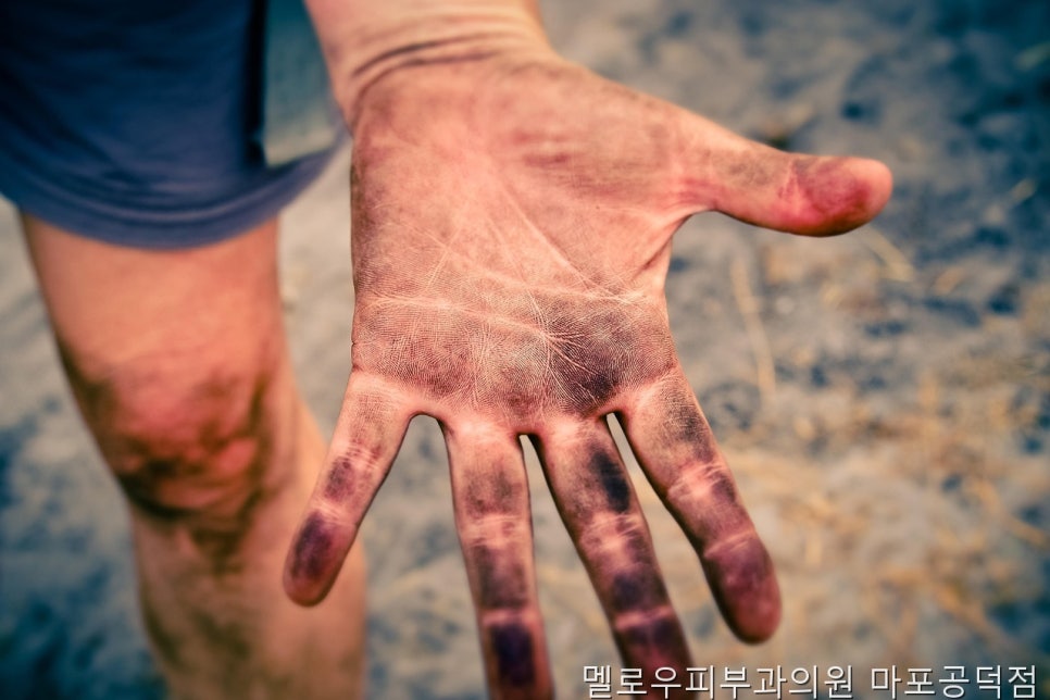 멜로우피부과의원 마포공덕점 사진 4