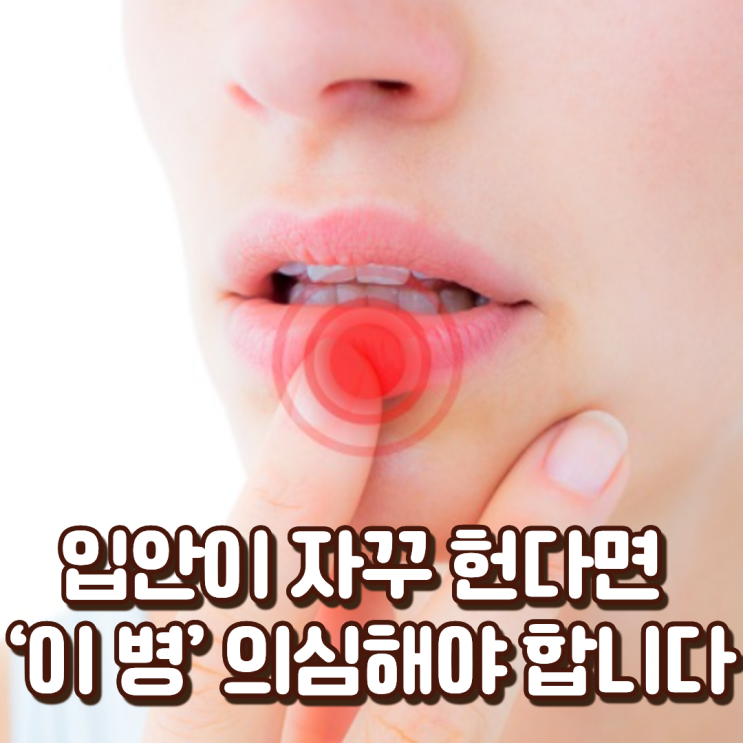  “피곤해서 그런 줄” 입안이 자꾸 헌다면 ‘이 병’ 의심해야 합니다