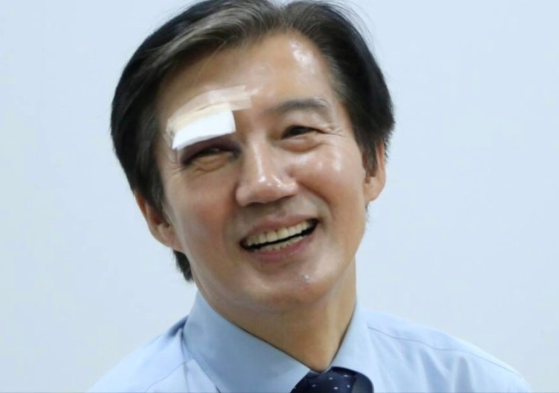 조국. 눈에 시퍼런 멍