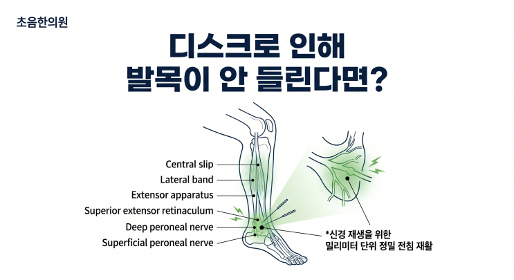 [족하수] 디스크로 인해 발목이 안들린다면