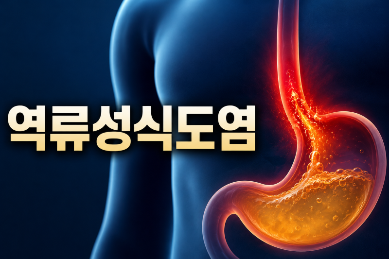 역류성식도염 좋은음식 먹는데 왜 더 심해질까?꼭 피해야 할 음식 정리