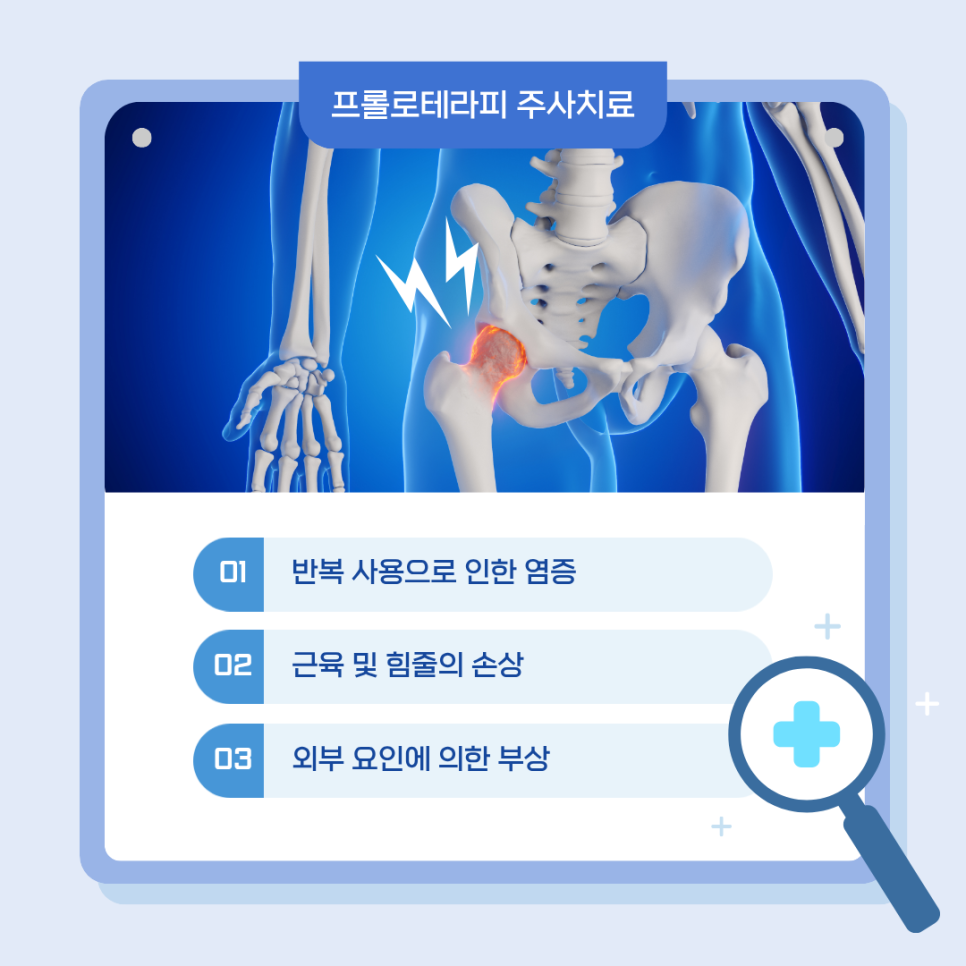 여의도 고관절통증 원인과 비수술적 관리 방법 프롤로테라피 주사치료 알아보기