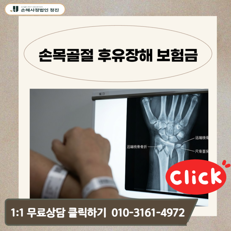  손목골절 후유장해 보험금,뼈가 붙었는데 지급 거절? 손해사정사가 직접 밝히는 보상 승소 전략