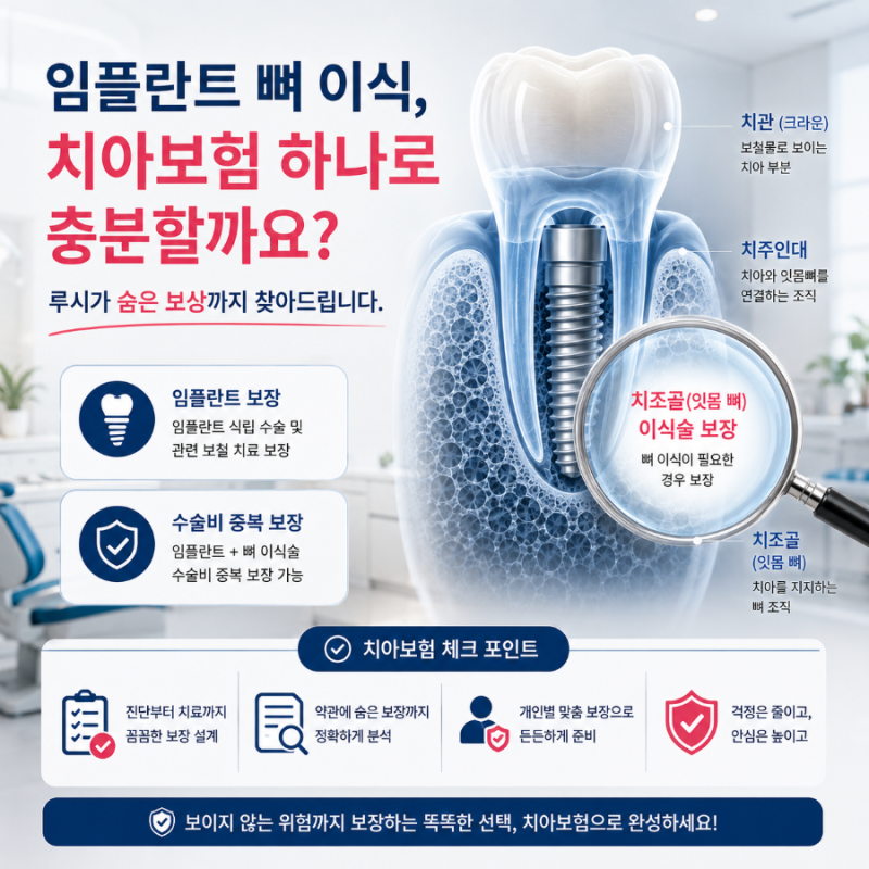 임플란트 뼈 이식, '치조골이식술' 보험금 못 받은 이유 1위?