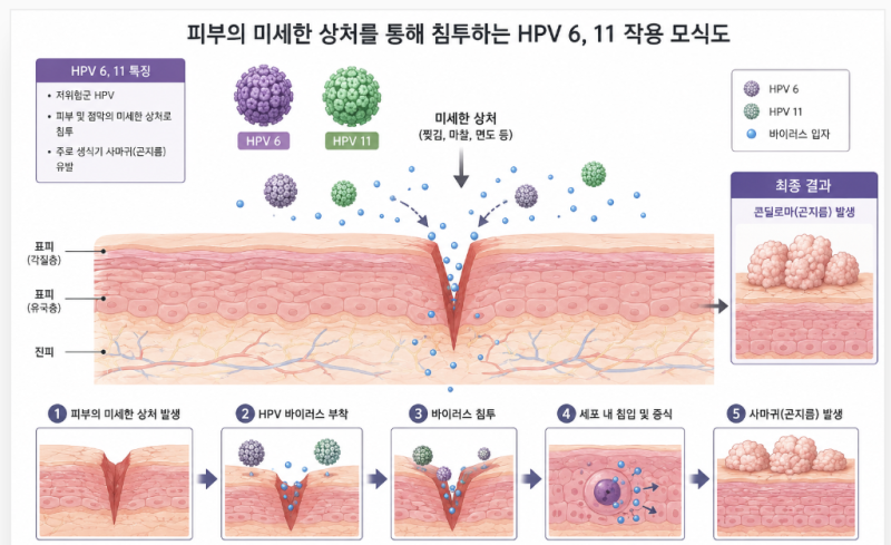 남자 곤지름 사진만 검색하지 말고 관리가 필요할 때