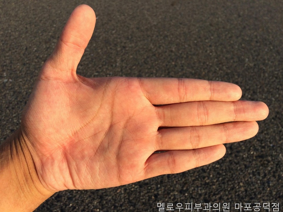 멜로우피부과의원 마포공덕점 사진 5