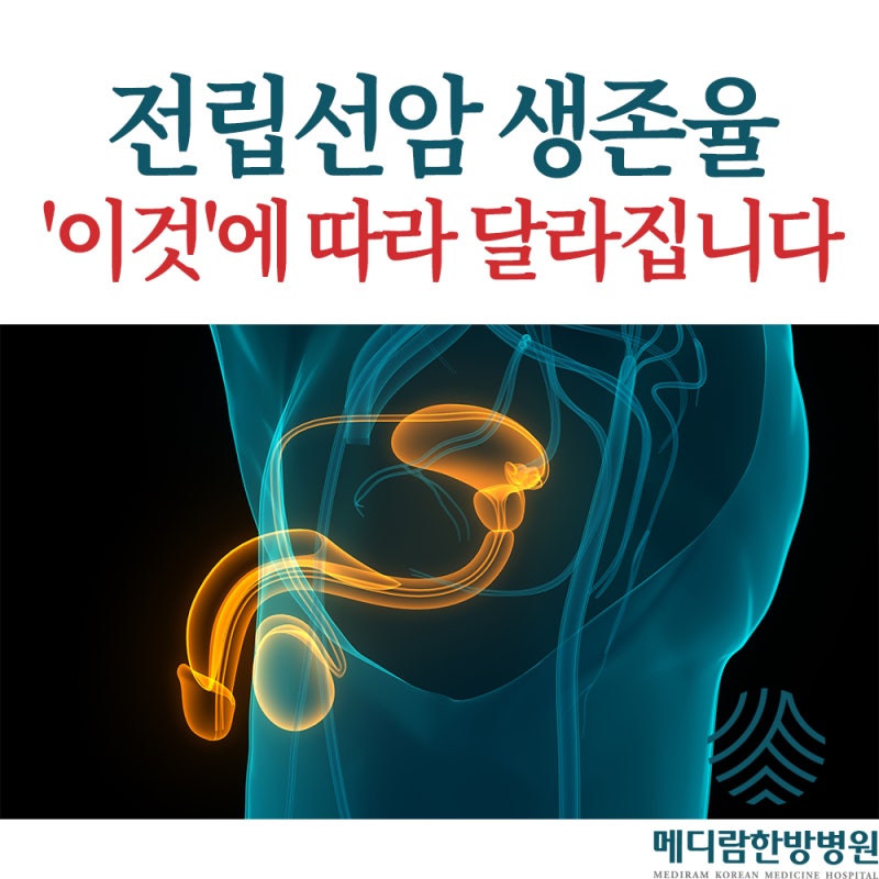 전립선암 생존율 '이것'에 따라 달라집니다