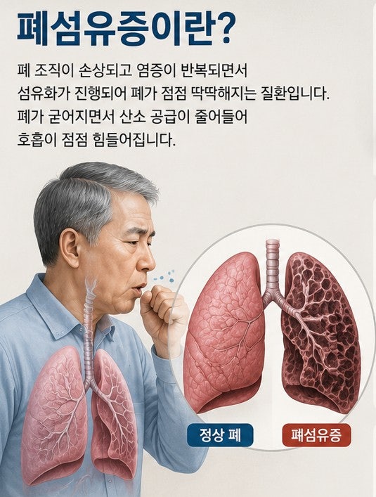 폐섬유증, 숨 차다면 의심해야 할 신호 (원인, 해결법, 생활관리)