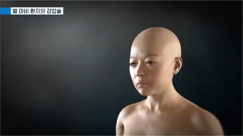 #명의 구안와사 vs 벨마비 차이, 안면마비 골든타임