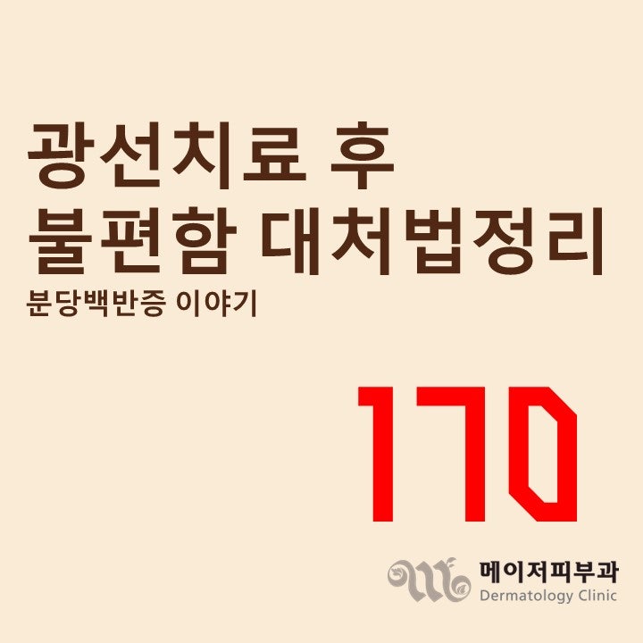 [백반증 이야기-170] 엑시머레이저·자외선치료 후 생길 수 있는 불편함 종류와 대처법 총정리....