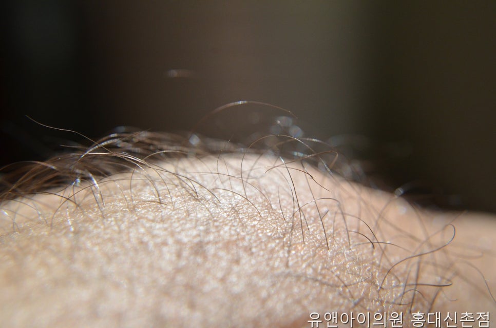 유앤아이의원 홍대신촌점 사진 3