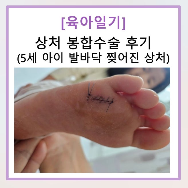 [육아일기] 5세 아이 발바닥 찢어진 상처 봉합수술 - 주말 응급실 진료 후기