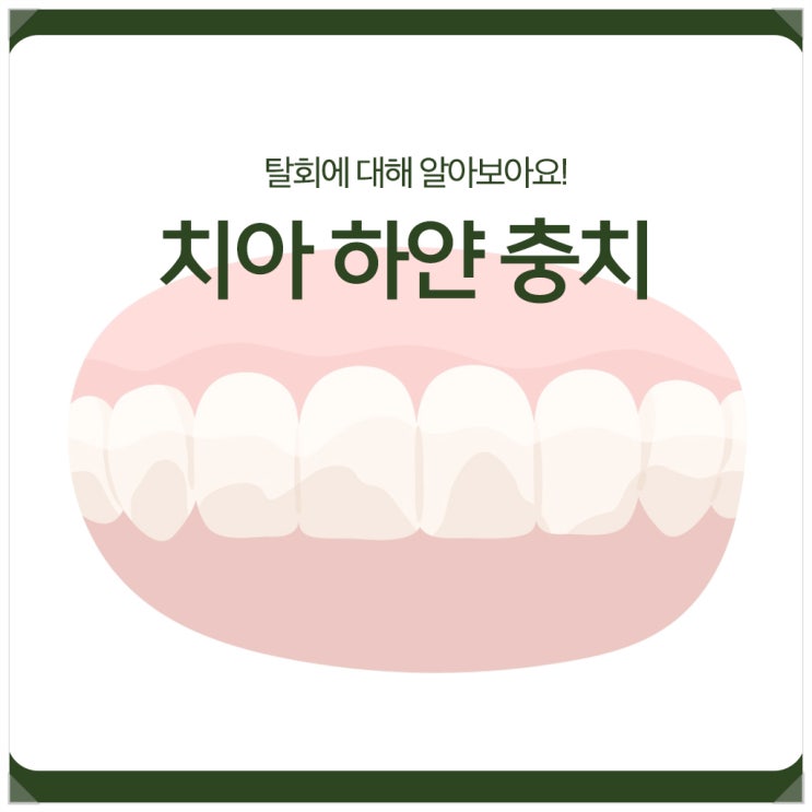  치아 하얀 충치, 탈회에 대해 알아보아요!