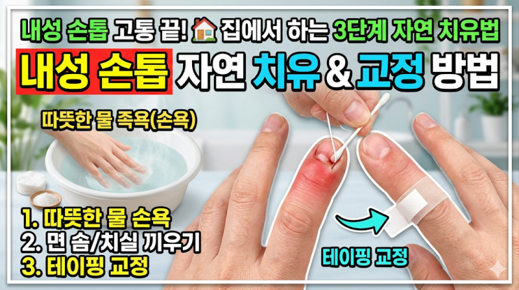  일자로 깎기부터 테이핑까지, 재발 없는 내성 손톱 관리의 모든 것