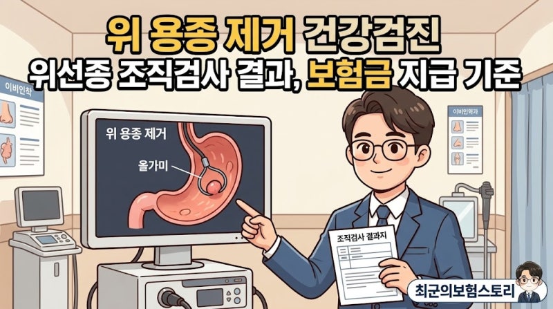 위 용종 제거 건강검진 위선종 조직검사 결과와 보험금 지급 기준