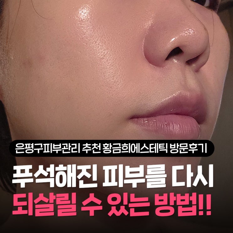  은평구피부관리 추천 황금희에스테틱 은평점 수부지 피부가 만족한 응암동 피부관리 솔직후기