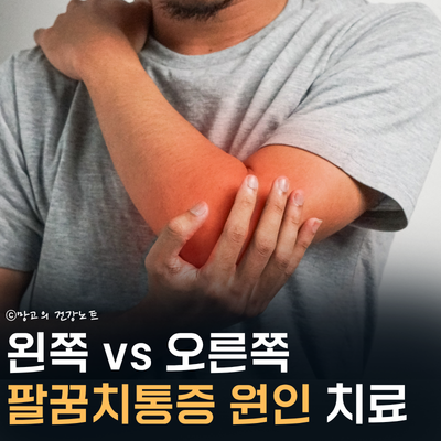 왼쪽 vs 오른쪽 팔꿈치통증 원인 | 테니스엘보 골프엘보 치료법은?