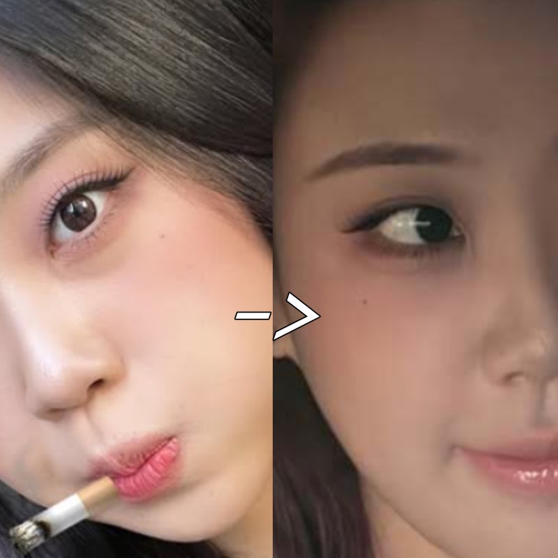 이영지 눈밑지 전후, 다이어트보다 더 화제인듯!