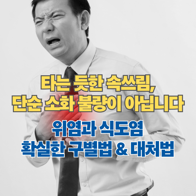  속쓰릴 때 원인 5가지와 해결법, 위염 역류성 식도염 증상 구별하기
