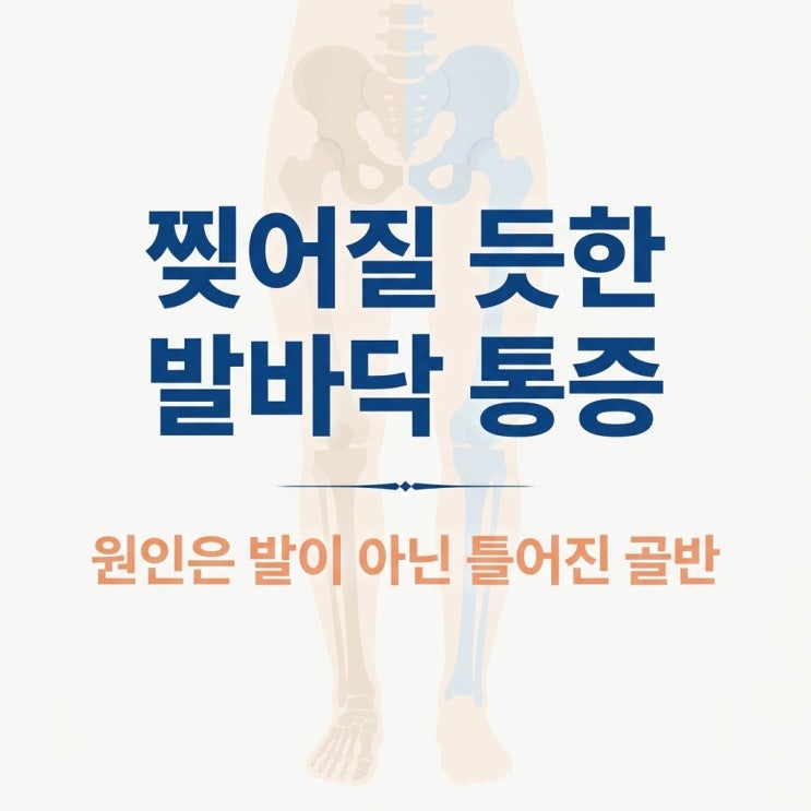  족저근막염 발바닥 통증, 체외충격파 한계와 골반 교정 한의원 치료
