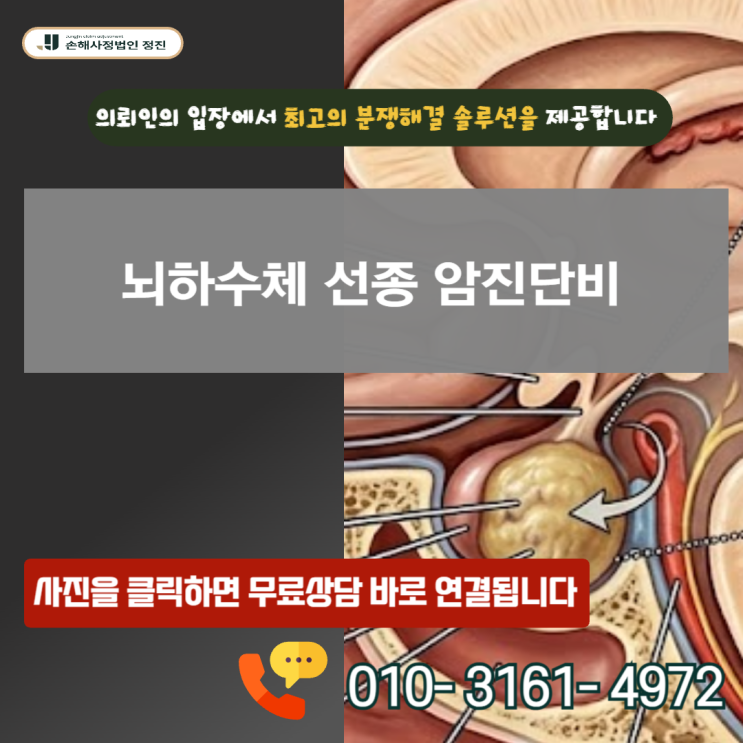  뇌하수체 선종 암진단비, 8천만 원 보상 갈림길이 된 D35.2 코드